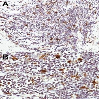 HICE1 Rabbit Polyclonal Antibody