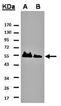 HICE1 Rabbit Polyclonal Antibody