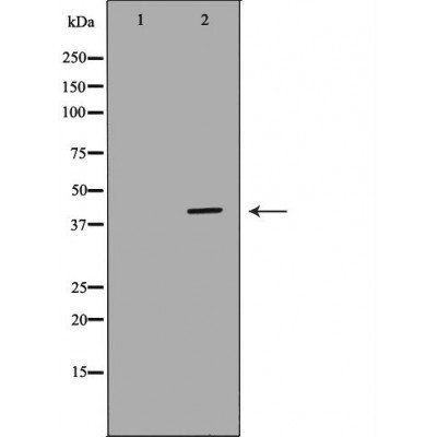 HIF1AN Antibody