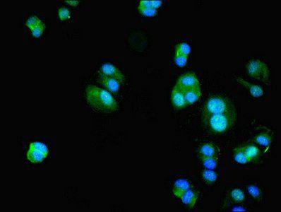 HIF1AN Antibody