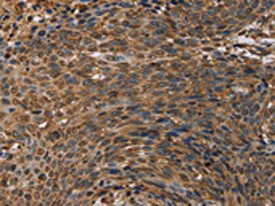 HIF1AN Antibody