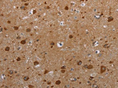 HIF1AN Antibody