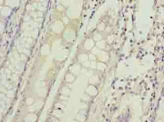 HIGD1B Antibody