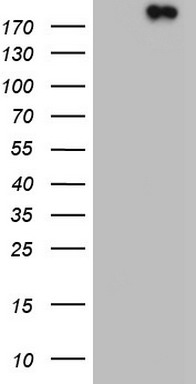 hIgG Kappa light chain Specific Rabbit monoclonal antibody