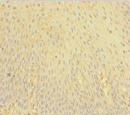 FCER1G Antibody