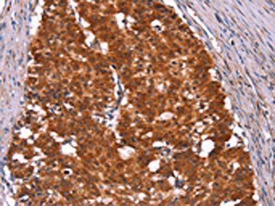 HINT1 Antibody