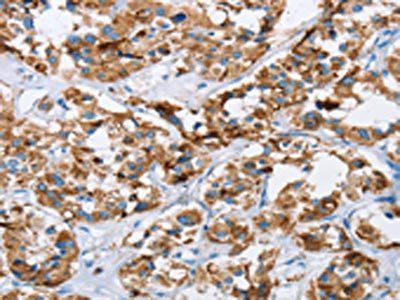 HINT2 Antibody