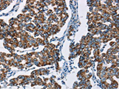 HINT2 Antibody