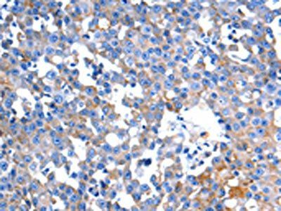 HINT2 Antibody