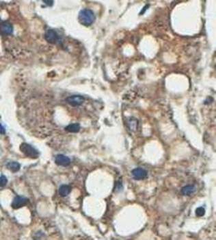 HINT2 Rabbit Polyclonal Antibody