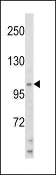 HIP116A antibody