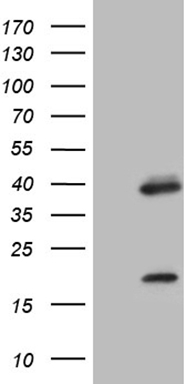 HIPK1 Antibody