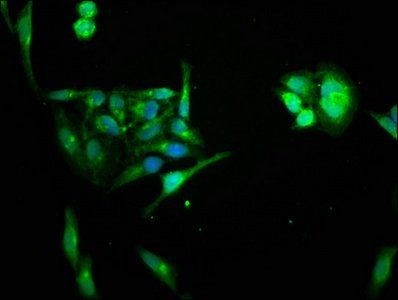 HIPK1 Antibody