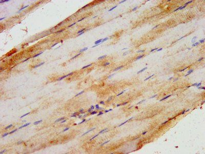 HIPK1 Antibody