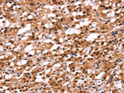 HIPK1 Antibody