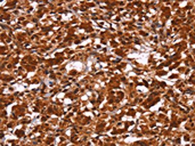 HIPK1 Antibody