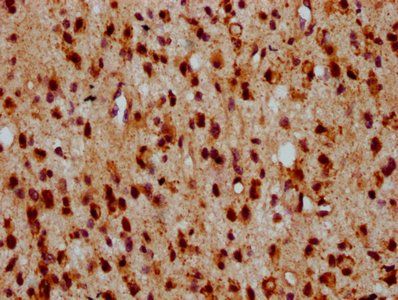 HIPK2 Antibody