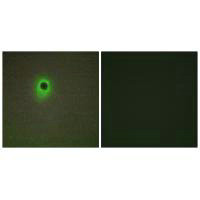 HIPK4 Antibody