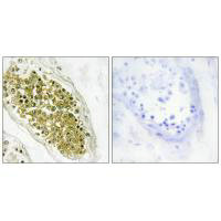 HIPK4 Antibody