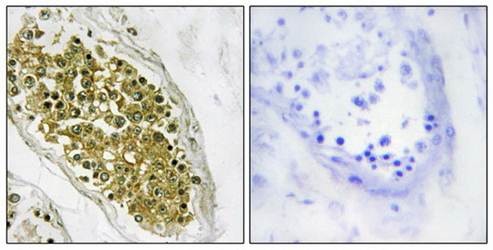 HIPK4 Antibody