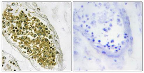 HIPK4 antibody