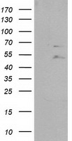 IFT57 Antibody