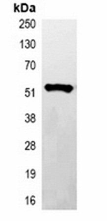 His-tag antibody