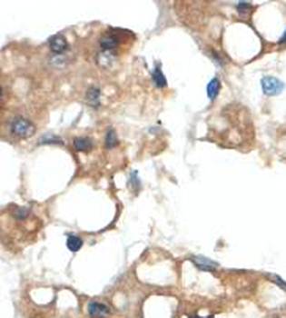HISPPD1 Rabbit Polyclonal Antibody
