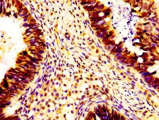 HIST1H1B Antibody