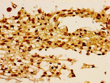 HIST1H1B Antibody