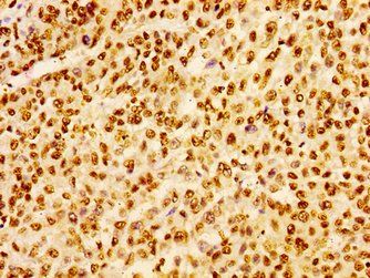 HIST1H1B Antibody