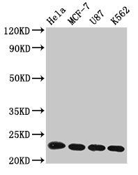 HIST1H1B Antibody