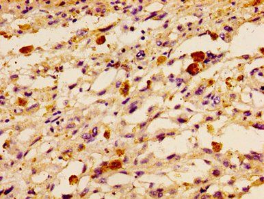HIST1H1B Antibody