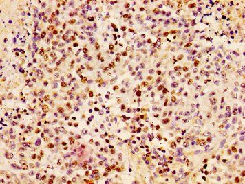 HIST1H1B Antibody