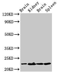 HIST1H1B (Ab-17) antibody