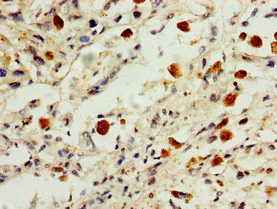 HIST1H1B Antibody