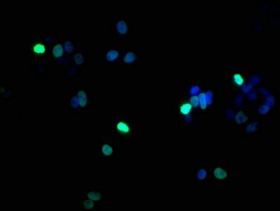 Phospho-HIST1H1B (S17) Antibody
