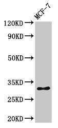Phospho-HIST1H1B (S17) Antibody