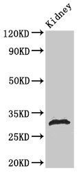 Phospho-HIST1H1B (S188) Antibody