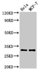 Phospho-HIST1H1B (T154) Antibody