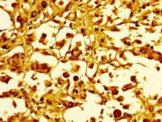 HIST1H1C Antibody