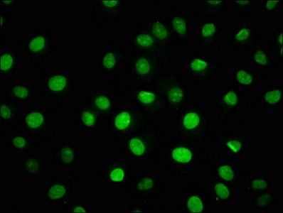 HIST1H1C Antibody