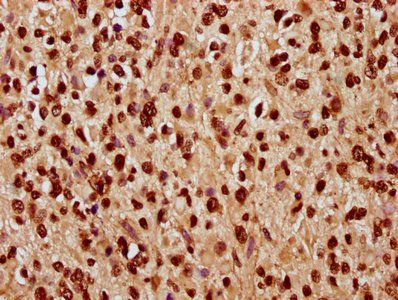 HIST1H1C Antibody
