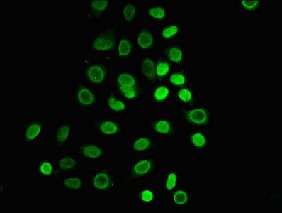 HIST1H1C Antibody
