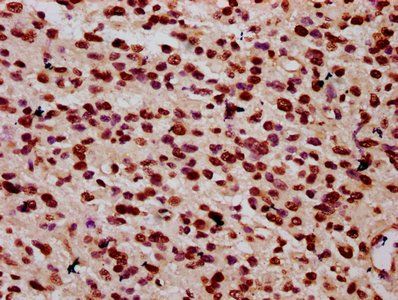HIST1H1C Antibody