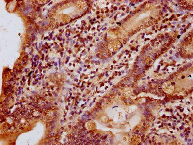 HIST1H1C Antibody