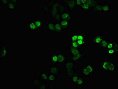 HIST1H1C (Ab-45) Antibody