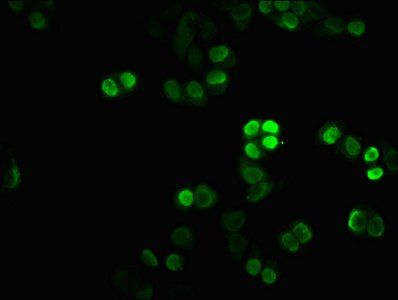 HIST1H1C (Ab-45) antibody