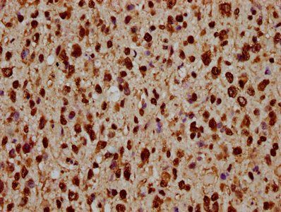 HIST1H1C (Ab-45) Antibody