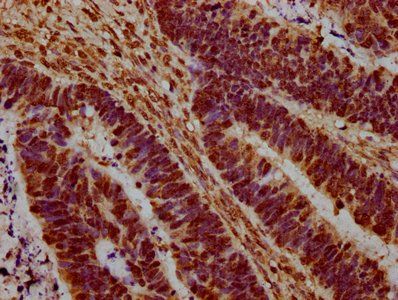 HIST1H1C (Ab-45) Antibody